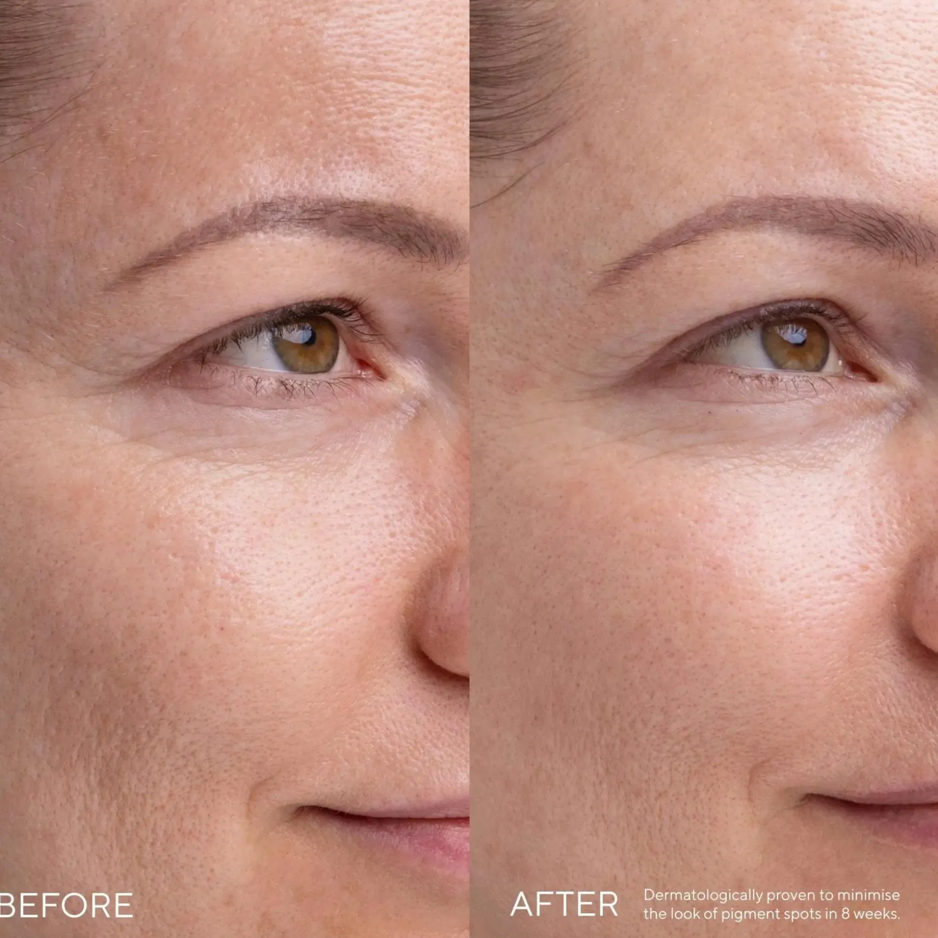 MADARA KOJIC ALTERNATIVE Pigment -seerumi 30ml